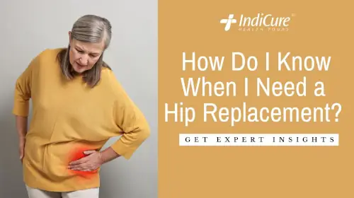 How Do I Know When I Need a Hip Replacement?